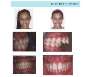 אורטודנט ברחובות