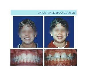 אורטודנט ברחובות